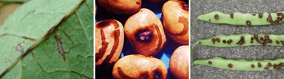 Esta imagem é uma composição de três fotografias que ilustram os sintomas da antracnose, uma doença fúngica causada pelo pató