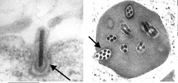 composição de duas micrografias eletrônicas que ilustram a morfologia de um vírus, provavelmente um baculovíru