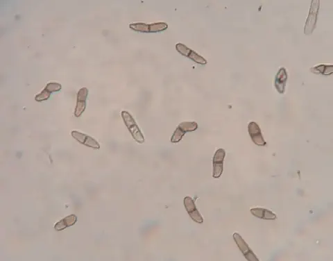 Esta imagem é uma micrografia que exibe conídios, que são esporos assexuados de um fungo. As estruturas observadas são pequen