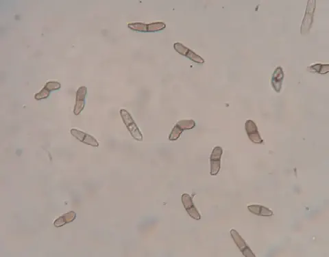 Esta imagem é uma micrografia que exibe conídios, que são esporos assexuados de um fungo. As estruturas observadas são pequen