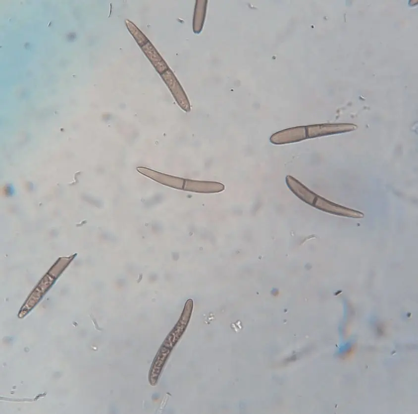 micrografia que exibe conídios (esporos assexuados) de um fungo fitopatogênico. As estruturas, vistas sob gran