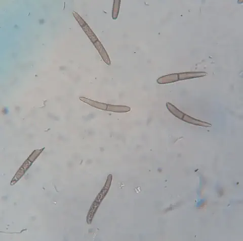 micrografia que exibe conídios (esporos assexuados) de um fungo fitopatogênico. As estruturas, vistas sob gran