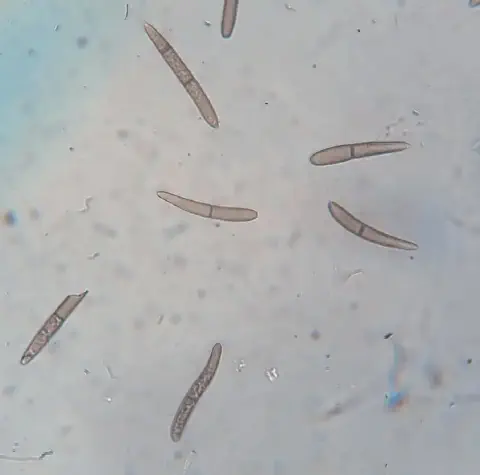 micrografia que exibe conídios (esporos assexuados) de um fungo fitopatogênico. As estruturas, vistas sob gran