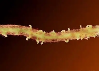 Visão ampliada de Rotylenchulus reniformis em raízes de soja, com massas de ovos visíveis. uma visão microscópica de uma raiz de planta severamente infestada por nematoides. A raiz, de coloração verde-
