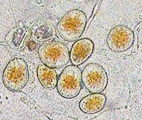 Esta é uma imagem de microscopia que exibe um agrupamento de oocistos, provavelmente do protozoário do gênero Eimeria, o agen